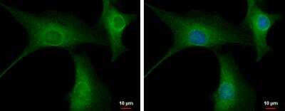 Immunocytochemistry/Immunofluorescence: PPP2R3A Antibody [NBP2-19908] - U87-MG cells were fixed in 4% paraformaldehyde at RT for 15 min. Green: PPP2R3A protein stained by PPP2R3A antibody [C2C3], C-term diluted at 1:500. Blue: Hoechst 33342 staining.