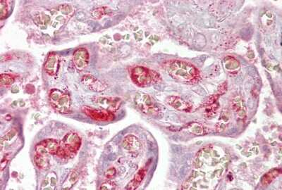 Immunohistochemistry-Paraffin: PPP2R3A Antibody [NBP1-54581] - Human placenta tissue at an antibody concentration of 5ug/ml.