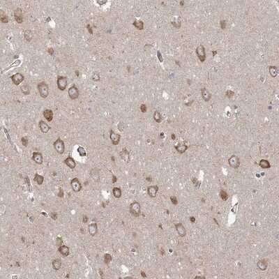 Immunohistochemistry-Paraffin: PPP2R3A Antibody [NBP1-87233] - Staining of human hippocampus shows moderate cytoplasmic positivity in neuronal cells.