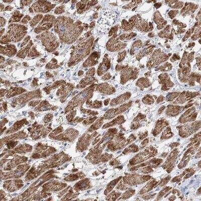 Immunohistochemistry-Paraffin: PPP2R3A Antibody [NBP1-87234] - Staining of human heart muscle shows distinct cytoplasmic positivity in myocytes.