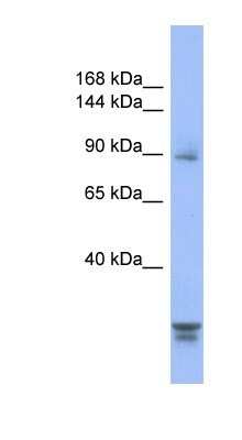 Western Blot: PPP2R3A Antibody [NBP1-54581] - 293T cell lysate, Antibody Titration: 0.2-1 ug/ml.