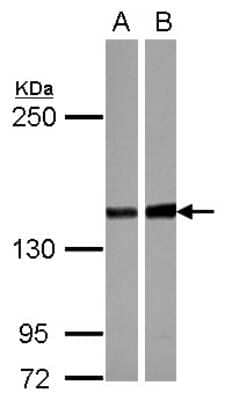 Western Blot: PPP2R3A Antibody [NBP2-19908] - Sample (30 ug of whole cell lysate) A: NT2D1 B: U87-MG 5% SDS PAGE gel, diluted at 1:1000.