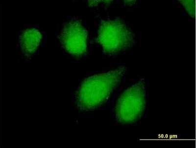 Immunocytochemistry/Immunofluorescence: PPP2R4 Antibody [H00005524-B01P] - Analysis of purified antibody to PPP2R4 on HeLa cell. (antibody concentration 10 ug/ml)