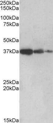 Western Blot: PPP2R4 Antibody [NBP1-51951] - Human Liver lysate (lane 1), Mouse Liver (lane 2) and Rat Liver (lane 3) (35ug protein in RIPA buffer). Primary incubation was 1 hour. Detected by chemiluminescence.