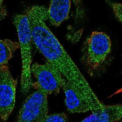 Immunocytochemistry/Immunofluorescence: PPP2R5A Antibody [NBP2-57154] - Staining of human cell line PC-3 shows localization to cytosol.