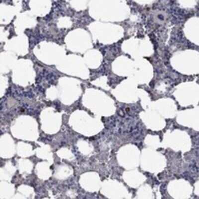 Immunohistochemistry-Paraffin: PPP2R5A Antibody [NBP3-17914] - Staining of human bone marrow shows strong cytoplasmic positivity in hematopoietic cells.