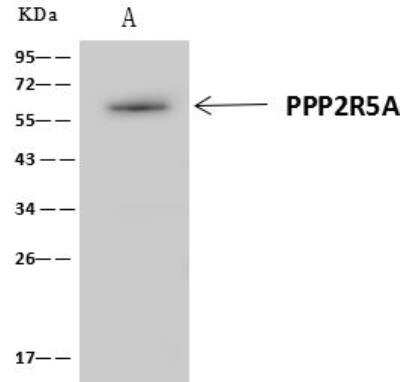 Immunoprecipitation: PPP2R5A Antibody [NBP3-12698] - Lane A:0.5 mg RT-4 Whole Cell Lysate4 uL anti-PPP2R5A rabbit polyclonal antibody and 60 ug of Immunomagnetic beads Protein A/G.Primary antibody:Anti-PPP2R5A rabbit polyclonal antibody,at 1:100 dilution Secondary antibody:Clean-Blot IP Detection Reagent (HRP) at 1:1000dilutionDeveloped using the ECL technique.Performed under reducing conditions.Predicted band size: 55 kDaObserved band size :57 kDa