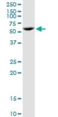 Western Blot: PPP2R5A Antibody [H00005525-B01P] - Analysis of PPP2R5A expression in Jurkat.