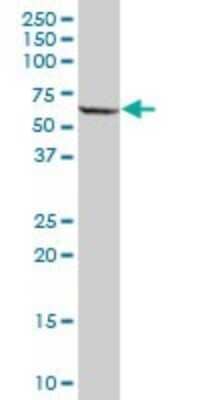 Western Blot: PPP2R5A Antibody [H00005525-B01P] - Analysis of PPP2R5A expression in human placenta.