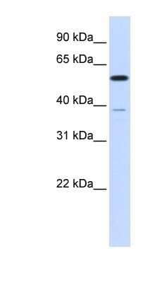 Western Blot: PPP2R5A Antibody [NBP1-53663] - Titration: 0.2-1 ug/ml, Positive Control: Transfected 293T.