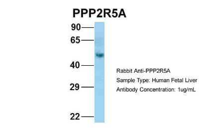 Western Blot: PPP2R5A Antibody [NBP1-53663] - Human Fetal Liver, Antibody Dilution: 1.0 ug/ml.