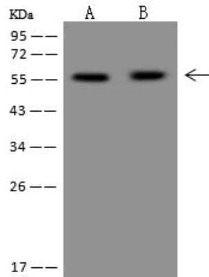 Western Blot: PPP2R5A Antibody [NBP3-12698] - Lane A: HeLa Whole Cell LysateLane B: RT-4 Whole Cell LysateLysates/proteins at 30 ug per lane.SecondaryGoat Anti-Rabbit IgG (H+L)/HRP at 1/10000 dilution.Developed using the ECL technique.Performed under reducing conditions.Predicted band size:55 kDaObserved band size:55 kDa