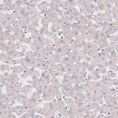 Immunohistochemistry-Paraffin: PPP2R5B Antibody [NBP1-88958] - Staining of human liver shows no positivity in hepatocytes as expected.