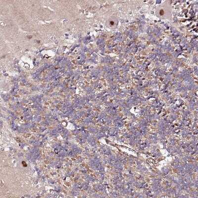 Immunohistochemistry-Paraffin: PPP2R5B Antibody [NBP1-88958] - Staining of human cerebellum shows moderate to strong nuclear positivity in Purkinje cells.