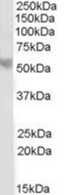 Western Blot PPP2R5B Antibody