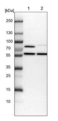 Western Blot: PPP2R5B Antibody [NBP1-88958] - Lane 1: NIH-3T3 cell lysate (Mouse embryonic fibroblast cells). Lane 2: NBT-II cell lysate (Rat Wistar bladder tumor cells).