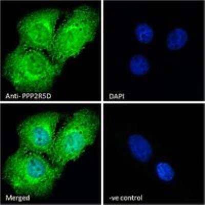Immunocytochemistry/Immunofluorescence: PPP2R5D Antibody [NB100-846] - Immunofluorescence analysis of paraformaldehyde fixed U2OS cells, permeabilized with 0.15% Triton. Primary incubation 1hr (10 ug/mL) followed by Alexa Fluor 488 secondary antibody (2 ug/mL), showing cytoplasmic and nuclear staining. The nuclear stain is DAPI (blue). Negative control: Unimmunized goat IgG (10 ug/mL) followed by Alexa Fluor 488 secondary antibody (2 ug/mL).