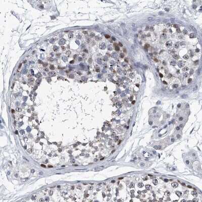 <b>Independent Antibodies Validation. </b>Immunohistochemistry-Paraffin: PPP2R5D Antibody [NBP1-88960] - Staining of human testis shows moderate cytoplasmic positivity in cells in seminiferous ducts.