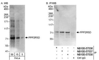 Western Blot: PPP2R5D Antibody [NB100-57536] - Detection of Human PPP2R5D on HeLa whole cell lysate using NB100-57536. PPP2R5D was also immunoprecipitated by rabbit anti-PPP2R5D antibodies NB100-57537 and NB100-57538.