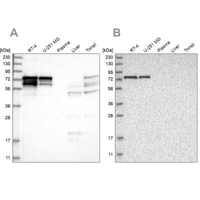 <b>Independent Antibodies Validation. </b>Western Blot: PPP2R5D Antibody [NBP1-88959] - Analysis using Anti-PPP2R5D antibody NBP1-88959 (A) shows similar pattern to independent antibody NBP1-88960 (B).
