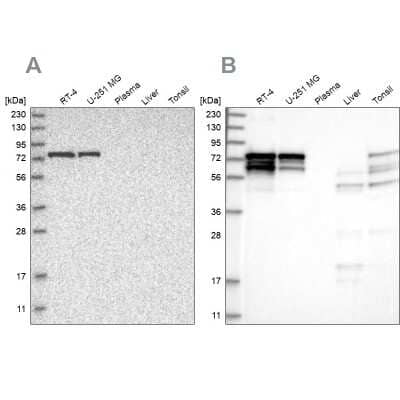 Western Blot: PPP2R5D Antibody [NBP1-88960] - Analysis using Anti-PPP2R5D antibody NBP1-88960 (A) shows similar pattern to independent antibody NBP1-88959 (B).