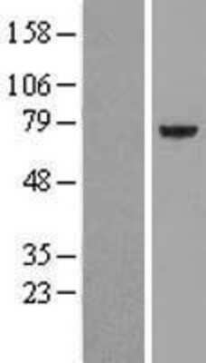 Western Blot: PPP2R5D Overexpression Lysate (Adult Normal) [NBL1-14704] Left-Empty vector transfected control cell lysate (HEK293 cell lysate); Right -Over-expression Lysate for PPP2R5D.