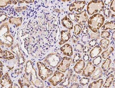 Immunohistochemistry-Paraffin: PPP2R5E Antibody [NBP3-06478] - Staining of human PPP2R5E in human kidney with rabbit polyclonal antibody at 1:100 dilution.