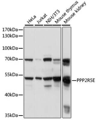 Western Blot: PPP2R5E Antibody [NBP2-95166] - Analysis of extracts of various cell lines, using PPP2R5E at 1:1000 dilution. Secondary antibody: HRP Goat Anti-Rabbit IgG (H+L) at 1:10000 dilution. Lysates/proteins: 25ug per lane. Blocking buffer: 3% nonfat dry milk in TBST. Detection: ECL Basic Kit . Exposure time: 1s.