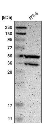 Western Blot: PPP3CB Antibody [NBP2-58920] - Western blot analysis in human cell line RT-4.