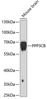 Western Blot: PPP3CB Antibody [NBP2-94864] - Analysis of extracts of mouse brain, using PPP3CB at 1:1000 dilution.Secondary antibody: HRP Goat Anti-Rabbit IgG (H+L) at 1:10000 dilution.Lysates/proteins: 25ug per lane.Blocking buffer: 3% nonfat dry milk in TBST.Detection: ECL Basic Kit .Exposure time