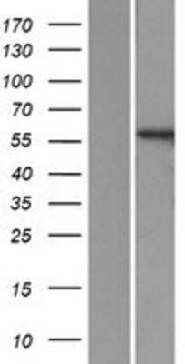 Western Blot: PPP3CB Overexpression Lysate (Adult Normal) [NBP2-06563] Left-Empty vector transfected control cell lysate (HEK293 cell lysate); Right -Over-expression Lysate for PPP3CB.