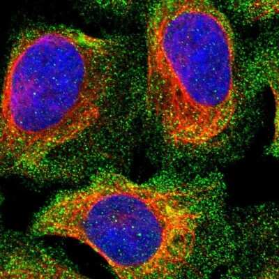 Immunocytochemistry/ Immunofluorescence PPP3CC Antibody