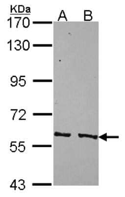 Western Blot: PPP3CC Antibody [NBP2-19911] - Sample (30 ug of whole cell lysate) A: NT2D1 B: IMR32 7. 5% SDS PAGE gel, diluted at 1:5000.