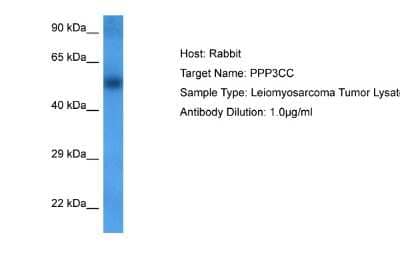 Western Blot: PPP3CC Antibody [NBP2-88086] - Host: Rabbit. Target Name: PPP3CC. Sample Tissue: leiomyosarcoma lysates. Antibody Dilution: 1ug/ml