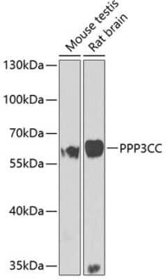 Western Blot: PPP3CC Antibody [NBP2-93403] - Analysis of extracts of various cell lines, using PPP3CC at 1:1000 dilution. Secondary antibody: HRP Goat Anti-Rabbit IgG (H+L) at 1:10000 dilution. Lysates/proteins: 25ug per lane. Blocking buffer: 3% nonfat dry milk in TBST. Detection: ECL Basic Kit . Exposure time: 90s.