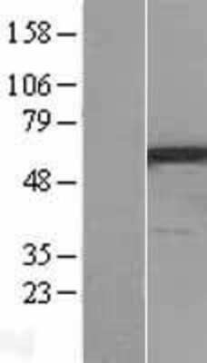 Western Blot: PPP3CC Overexpression Lysate (Adult Normal) [NBL1-14706] Left-Empty vector transfected control cell lysate (HEK293 cell lysate); Right -Over-expression Lysate for PPP3CC.