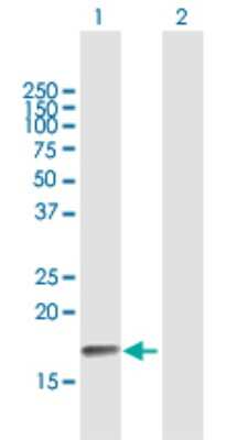 Western Blot: PPP3R2 Antibody [H00005535-B01P] - Analysis of PPP3R2 expression in transfected 293T cell line by PPP3R2 polyclonal antibody.  Lane 1: PPP3R2 transfected lysate(19.03 KDa). Lane 2: Non-transfected lysate.
