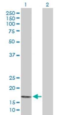 Western Blot: PPP3R2 Antibody [H00005535-D01P] - Analysis of PPP3R2 expression in transfected 293T cell line by PPP3R2 polyclonal antibody.Lane 1: PPP3R2 transfected lysate(19.90 KDa).Lane 2: Non-transfected lysate.