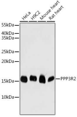 Western Blot PPP3R2 Antibody - BSA Free