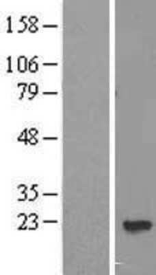 Western Blot: PPP3R2 Overexpression Lysate (Adult Normal) [NBL1-14708] Left-Empty vector transfected control cell lysate (HEK293 cell lysate); Right -Over-expression Lysate for PPP3R2.