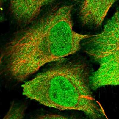 Immunocytochemistry/Immunofluorescence: PP4/PPP4C Antibody [NBP2-13802] - Staining of human cell line U-2 OS shows localization to nucleus, plasma membrane & cytosol. Antibody staining is shown in green.