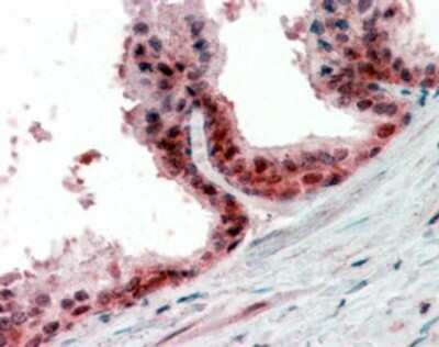 Immunohistochemistry-Paraffin: PPP4C Antibody [NBP1-51947] - (2.5ug/ml) staining of paraffin embedded Human Prostate. Steamed antigen retrieval with citrate buffer pH 6, AP-staining.