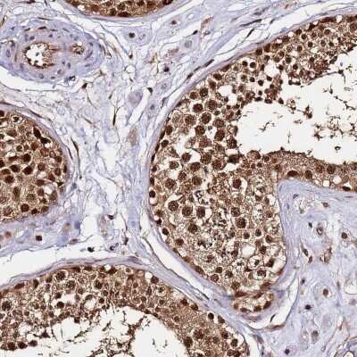 Immunohistochemistry-Paraffin: PP4/PPP4C Antibody [NBP2-13802] - Staining of human testis shows high expression.