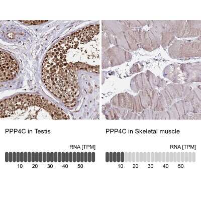 Immunohistochemistry-Paraffin PP4/PPP4C Antibody