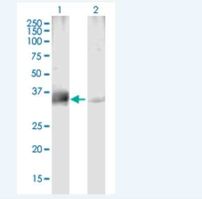 Western Blot: PPP4C Antibody [H00005531-B01P-50ug] - Analysis of PPP4C expression in transfected 293T cell line (H00005531-T02) by PPP4C MaxPab polyclonal antibody.  Lane 1: PPP4C transfected lysate(35.1 KDa). Lane 2: Non-transfected lysate.