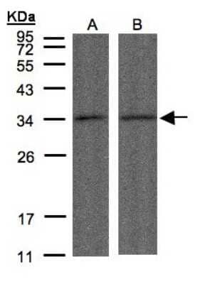 Western Blot: PPP4C Antibody [NBP1-31117] - (30 ug of whole cell lysate) A: A431 B :HeLa S3 12% SDS PAGE, antibody diluted at 1:500.