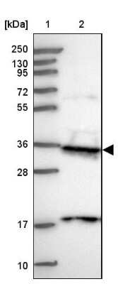 <b>Orthogonal Strategies Validation. </b>Western Blot: PP4/PPP4C Antibody [NBP2-13802] -  Lane 1: Marker  [kDa] 250, 130, 95, 72, 55, 36, 28, 17, 10.  Lane 2: Human cell line RT-4