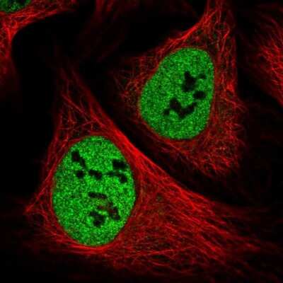 Immunocytochemistry/ Immunofluorescence PPP4R1 Antibody