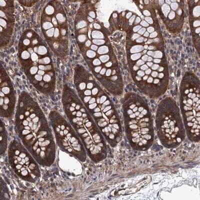 <b>Independent Antibodies Validation. </b>Immunohistochemistry-Paraffin: PPP4R1 Antibody [NBP1-87241] - Staining of human colon shows strong cytoplasmic positivity in glandular cells.