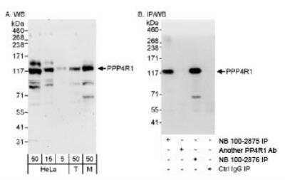 Western Blot: PPP4R1 Antibody [NB100-2875] - Detection of Human and Mouse PPP4R1 on HeLa whole cell lysate (5, 15, 50 microgram), 293T (T; 50 microgram), and NIH3T3 (M; 50 microgram) using NB100-2875. PPP4R1 was also immunoprecipitated by rabbit anti-PPP4R1 antibody NB100-2876 and another PP4R1 Ab.